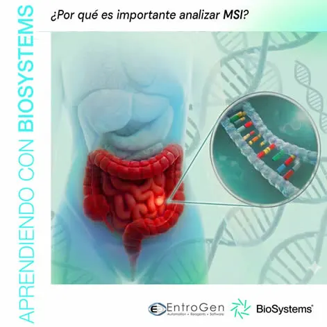 ¿Por qué es importante analizar MSI?